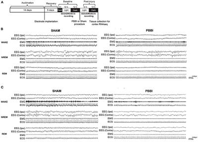 Penetrating Ballistic Brain Injury Produces Acute Alterations in Sleep and Circadian-Related Genes in the Rodent Cortex: A Preliminary Study